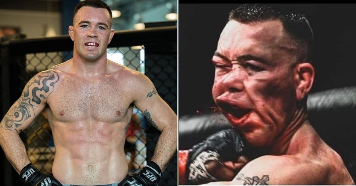 colby-covington-healing-up