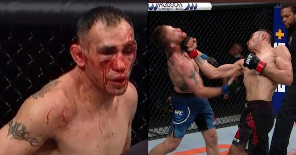 report-tony-ferguson-injury