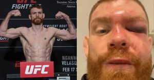 paul-felder-photos-injuries
